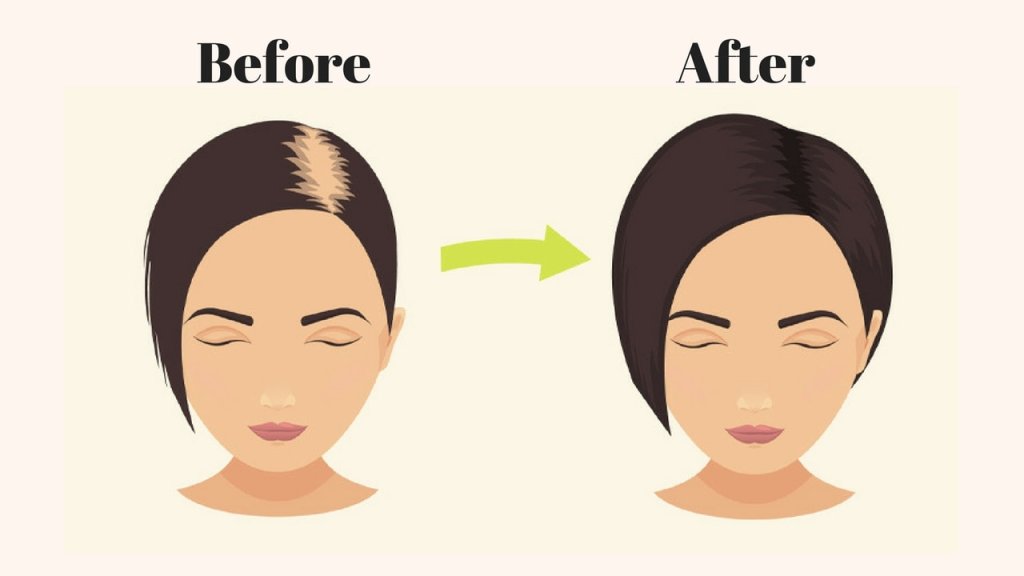 What Causes Hair Fall